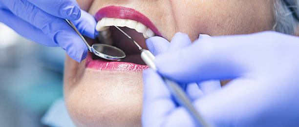 Best Dentist for Tooth Abscess  in Forreston, IL